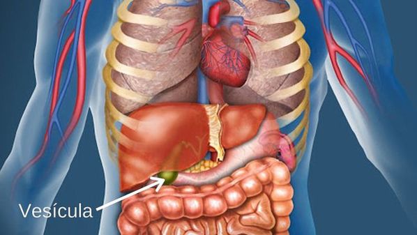 Qual o tempo de recuperação da cirurgia para retirar pedra da vesícula Médico Responde